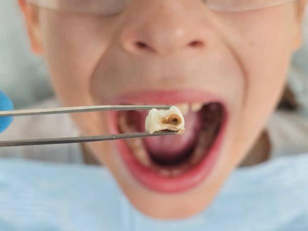 Best Pediatric Emergency Dentist in Elk Ridge, UT